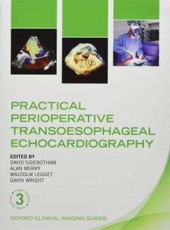 Practical Perioperative Transoesophageal Echocardiography