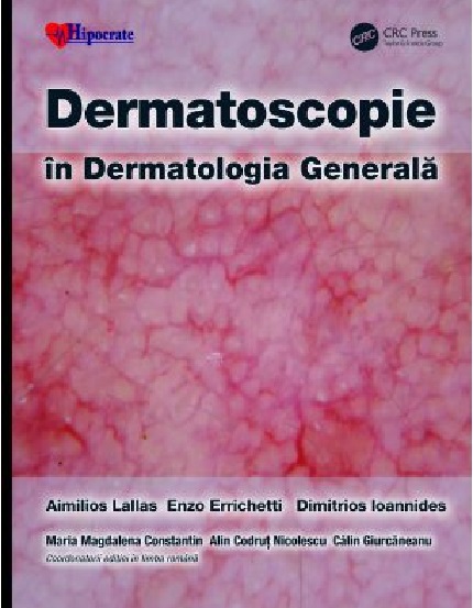 Dermatoscopie in Dermatologia Generala