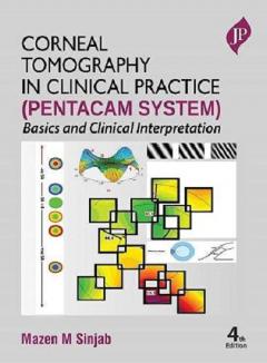 Corneal Tomography in Clinical Practice (Pentacam System)