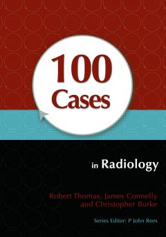  100 Cases in Radiology