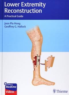 Lower Extremity Reconstruction