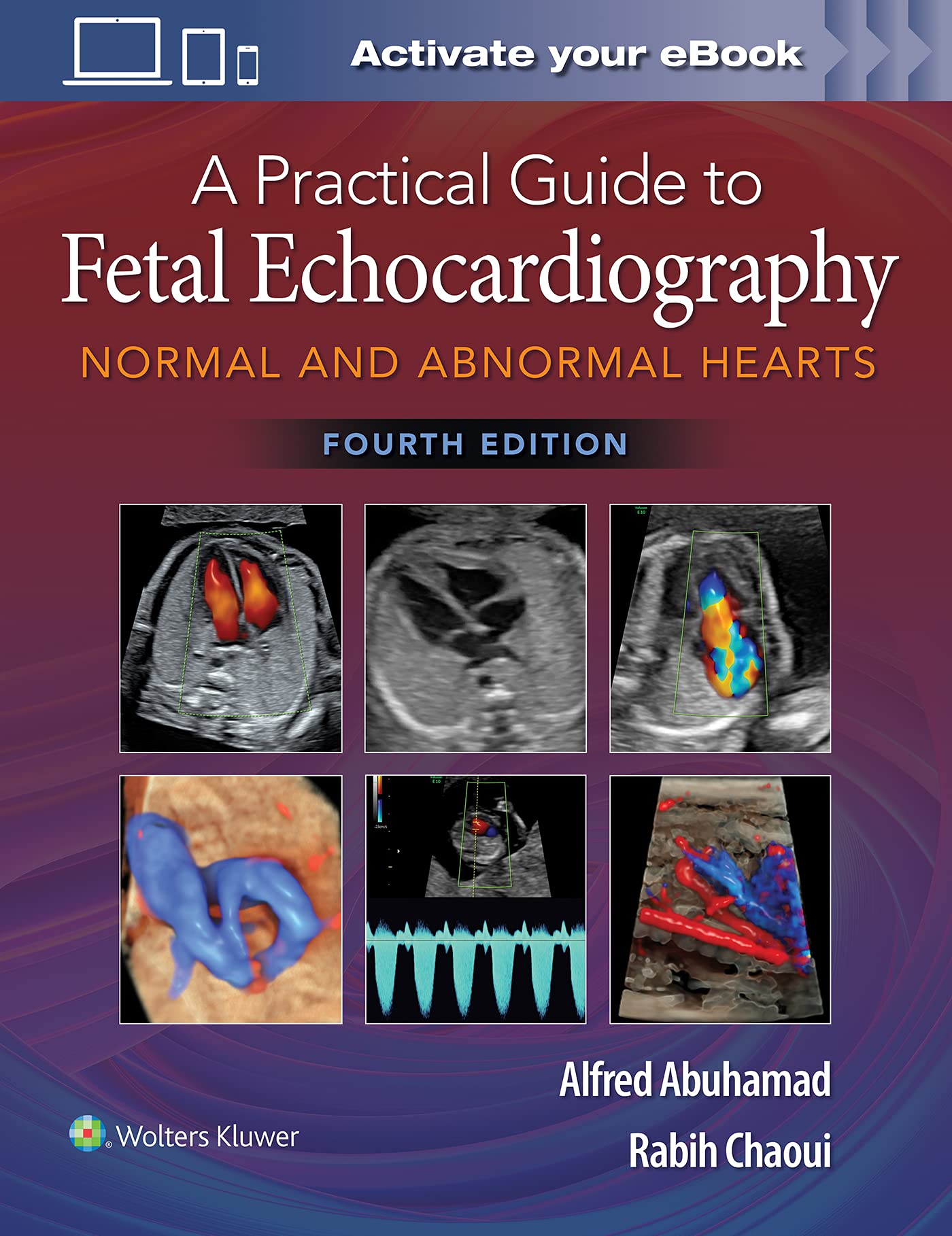 A Practical Guide to Fetal Echocardiography Alfred Z. Abuhamad, Rabih