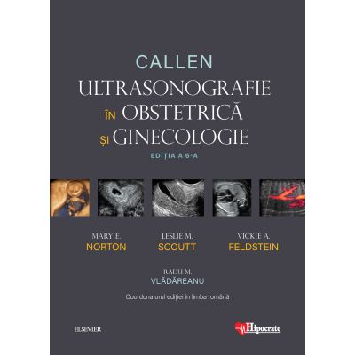 Ultrasonografie in Obstetrica si Ginecologie