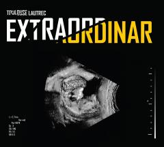 Extraordinar