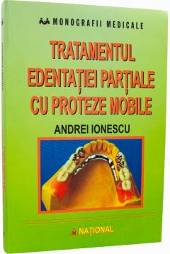 Tratamentul edentatiei partiale cu proteze mobile