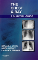 The Chest X-Ray: A Survival Guide