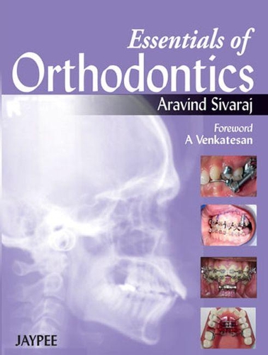 Essentials of Orthodontics - Aravind Sivaraj