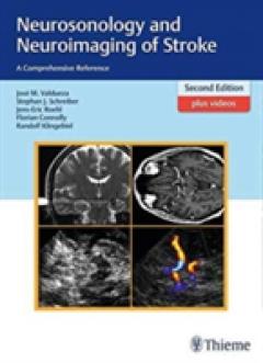 Neurosonology and Neuroimaging of Stroke