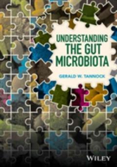 Understanding the Gut Microbiota