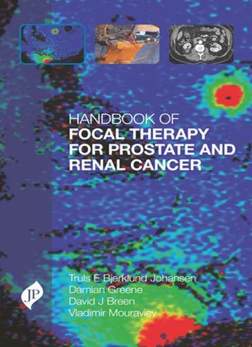 Handbook of Focal Therapy for Prostate and Renal Cancer - Truls E ...
