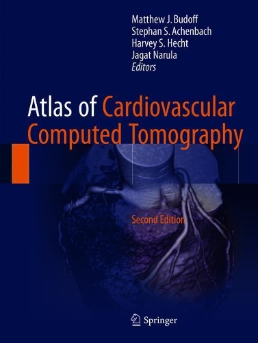 健康・医学 AtlasofCardiovascularComputedTomography Atlas of Vascular Surgery and Endovascular Therapy Anatomy and