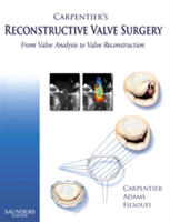Carpentier&#039;s Reconstructive Valve Surgery