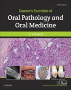 Cawson's Essentials of Oral Pathology and Oral Medicine