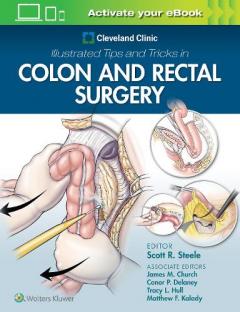 Cleveland Clinic Illustrated Tips and Tricks in Colorectal      Surgery