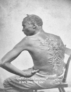 Coperta cărții "Universally Despised" Is My Skin the Sin?