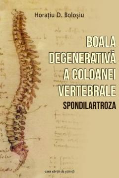 Boala degenerativa a coloanei vertebrale